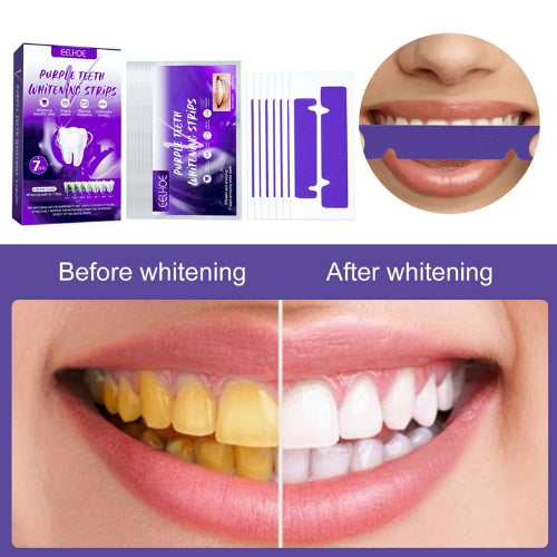 Prikaz Eelhoe ljubičastih trakica za izbeljivanje zuba i rezultata pre i posle korišćenja. Gornji levi deo prikazuje pakovanje trakica. Pored njega su same trakice i aplikator. U gornjem desnom uglu je prikaz upotrebe trakice na zubima. Donji deo slike je podeljen na dva dela: "Before whitening" (Pre izbeljivanja) sa žutim zubima i "After whitening" (Posle izbeljivanja) sa belim zubima.