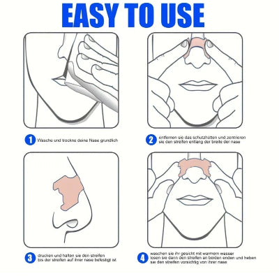 Detaljan prikaz kako se postavljaju flasteri za nos. Korak-po-korak uputstvo za postavljanje lepljive trake na nos.