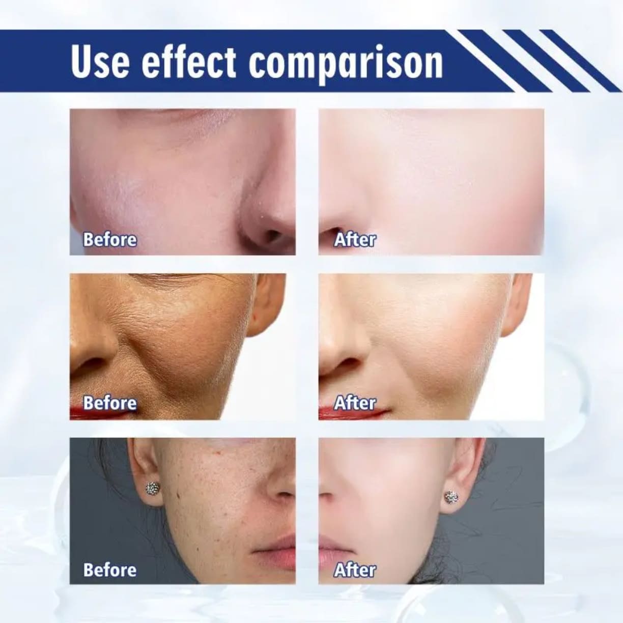 Serum za uklanjanje hiperpigmentacije i fleka na koži rezultat
