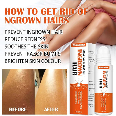 Uklanjanje uraslih dlaka i crvenila sa nogu. Resenje pre i posle upotrebe. Poboljsava boju koze i smanjuje fleke.