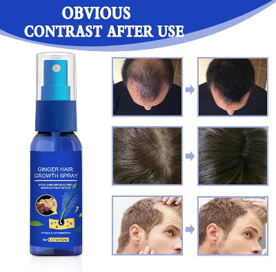 Fotografije koje pokazuju ocigledno poboljsanje gustine i rasta kose nakon koriscenja spreja.