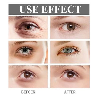 Krema za bore i podocnjake - Azijashop