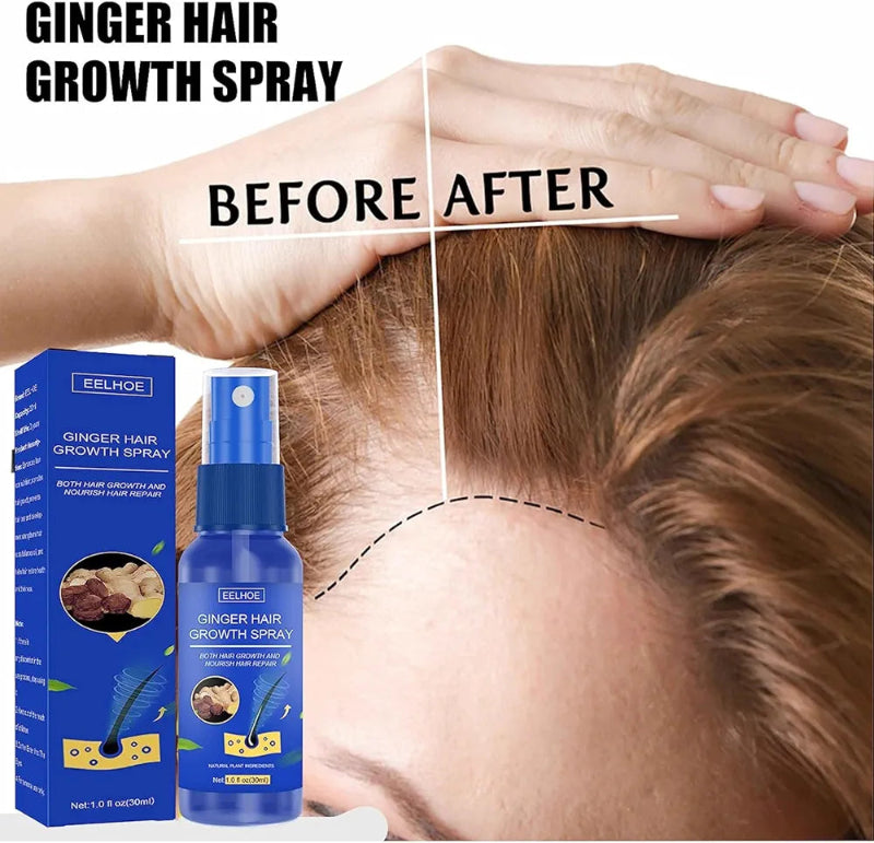 Serum za rast kose Djumbir sprej - Azijashop