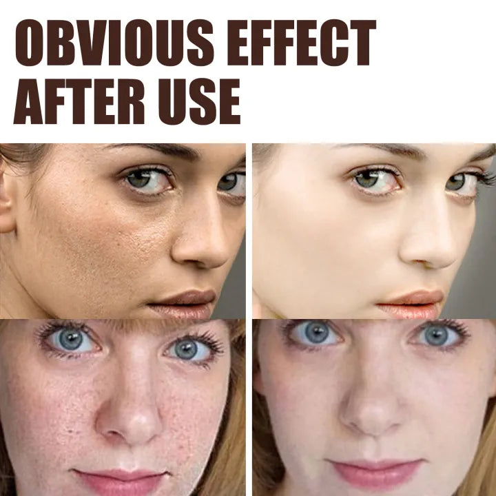 Elhoe Krema protiv starenja retinol Anti-aging - Azijashop