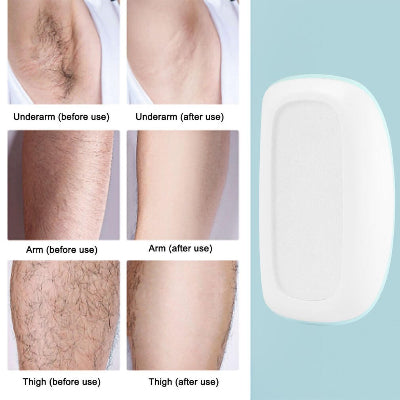 Nano Kristalni Epilator