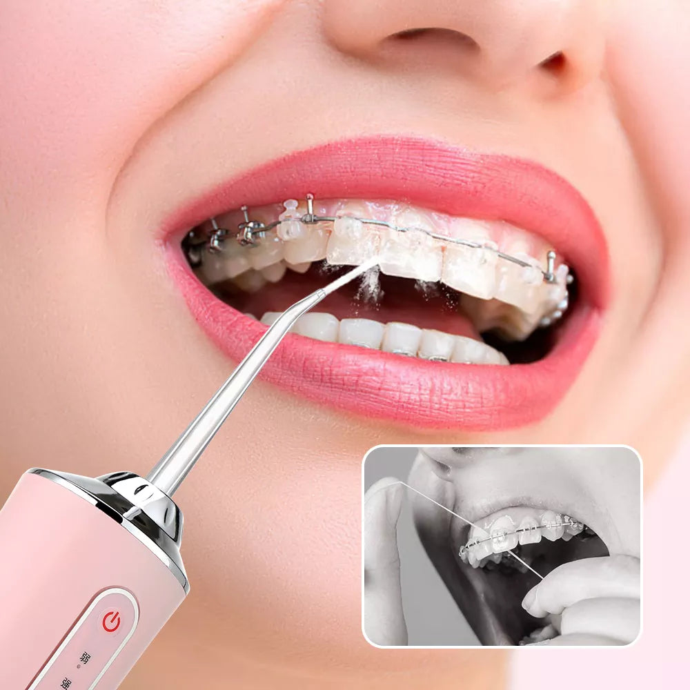 Oralni Irigator za Dubinsko Ispiranje Desni i Zuba - Azijashop