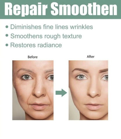 Prikaz pre i posle upotrebe kolagen seruma. Smanjuje fine linije, izgladjuje teksturu koze i vraca sjaj licu. Vidljivi rezultati.