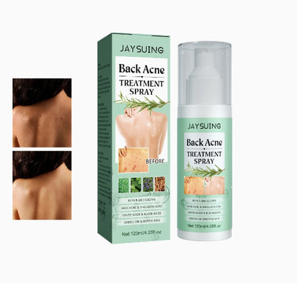 Sprej za akne na ledjima - Azijashop