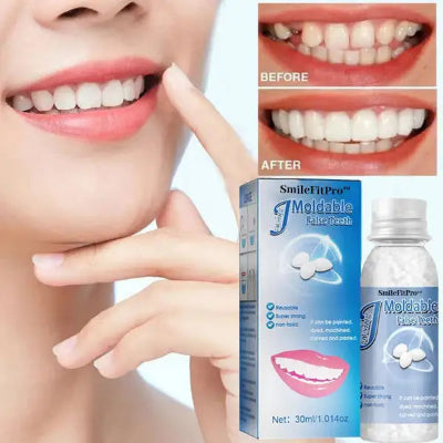 Premijum SmileFitPro masa za zube za privremene plombe i popravke zuba za savrsen osmeh i samopouzdanje