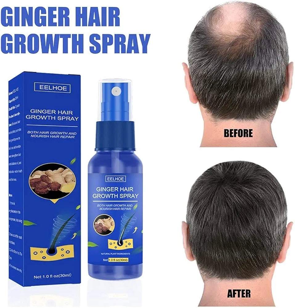 Serum za rast kose Djumbir sprej - Azijashop