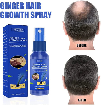 Serum za rast kose Djumbir sprej - Azijashop