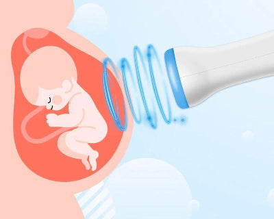 Ilustracija ultrazvucne sonde fetalnog doplera-neznoscu prati otkucaje srca bebe u stomaku-siguran uredjaj za trudnocu.