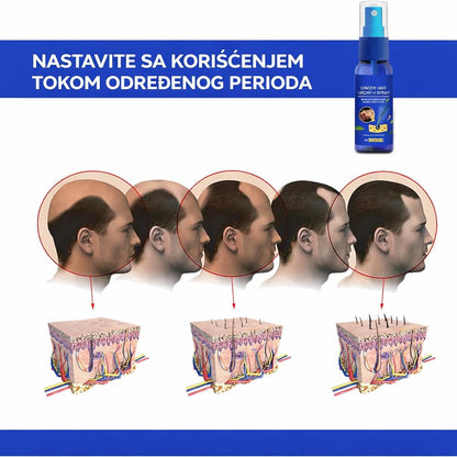Aktivacija folikula i rast nove kose