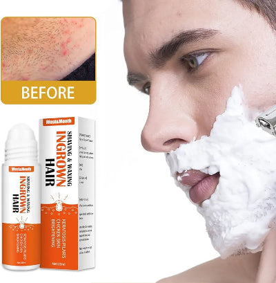 Preparat za urasle dlake na licu muskarca posle brijanja, sprecava svrab, iritacije i crvene bubuljice.