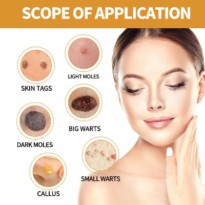 Podrucje primene Eelhoe seruma: mladezi, bradavice, papilomi, kozne izrasline i calluses. Savrsena koza bez fleka.