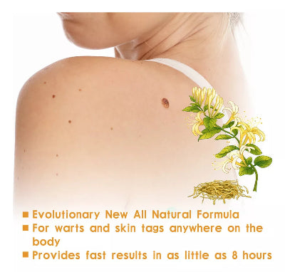 Rezultati koriscenja Eelhoe seruma za uklanjanje bradavica s vrata i ledja. Pruzite sebi prelepu kozu bez papiloma.