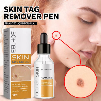 Eelhoe skin tag remover pen, jednostavna primena na kozne izrasline, bradavice i mladeze. Uklanja fleke, calluses i papilome.