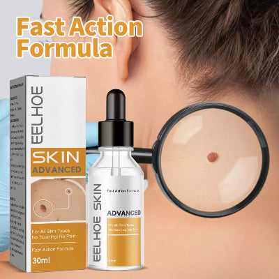 Eelhoe skin tag remover serum za uklanjanje bradavica, papiloma i koznih izraslina sa lica i tela. Brzo i efikasno delovanje.