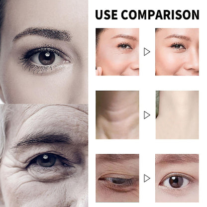 Prikaz poređenja pre i posle upotrebe Eelhoe Vitamin C Seruma. Levo su krupni planovi ženskog i muškog oka sa vidljivim borama oko očiju. Desno, pod naslovom "USE COMPARISON" (Poređenje upotrebe), nalaze se tri seta slika pre i posle tretmana, označena trouglom koji pokazuje prelaz sa "pre" na "posle": bore oko ženskog oka, bore na vratu i tamni kolutovi oko muškog oka. Slike "posle" prikazuju smanjenje bora i tamnih kolutova.