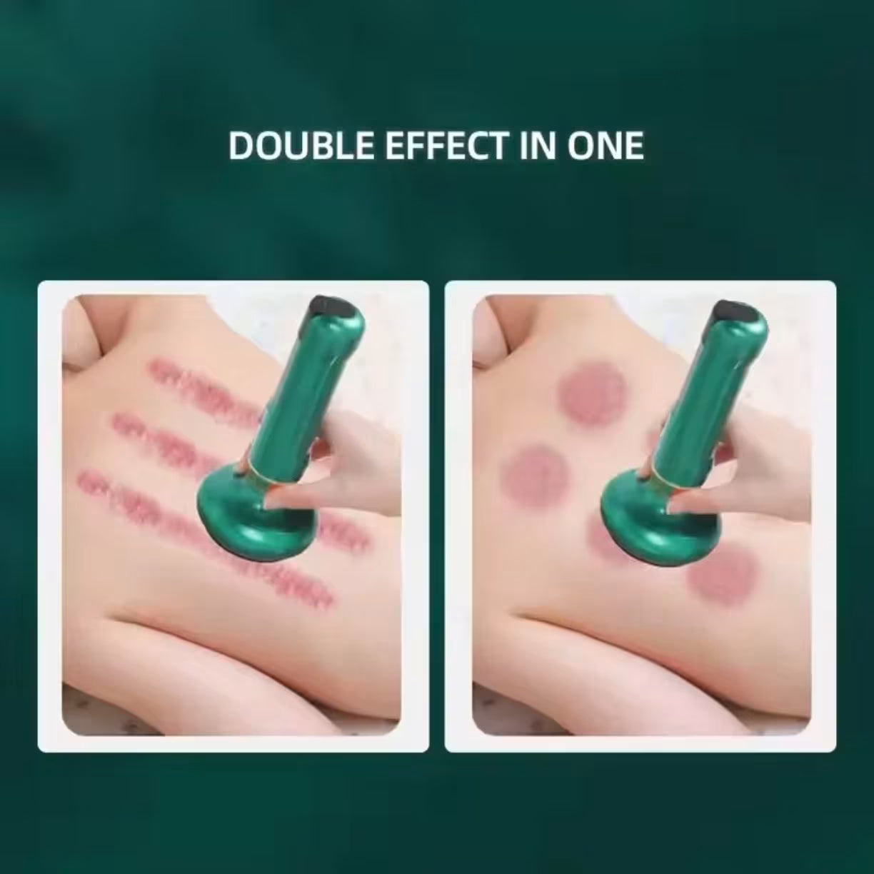Uporedni prikaz primene masažera za gua sha linijsku i vakuumsku cupping masažu