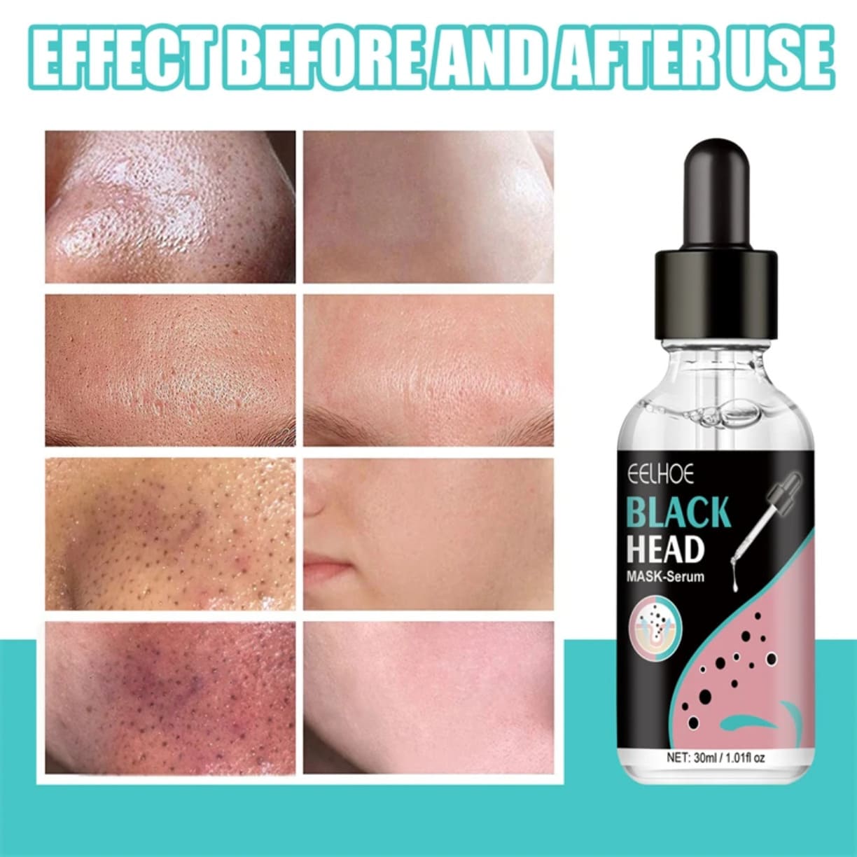 Kozmetički serum za dubinsko čišćenje lica