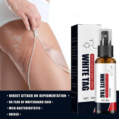 White Tag tretman za vitiligo. Prikaz nanošenja spreja na depigmentisane delove kože, vraća koži prirodnu boju i smanjuje vidljivost belih fleka.