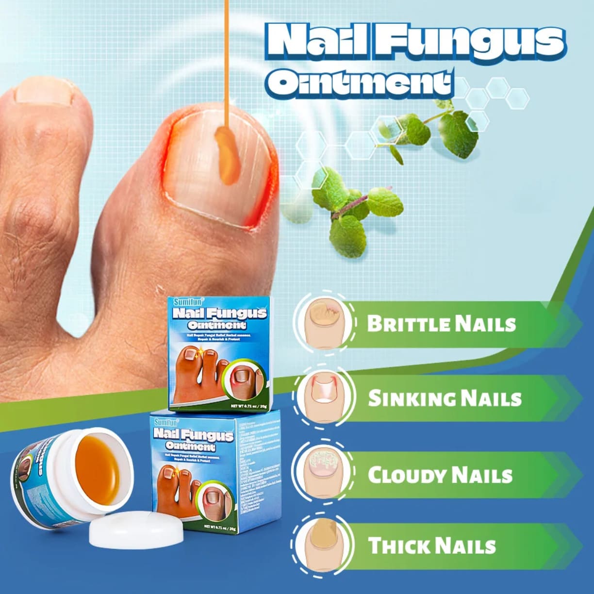 Nail Fungus Ointment krema protiv gljivica noktiju