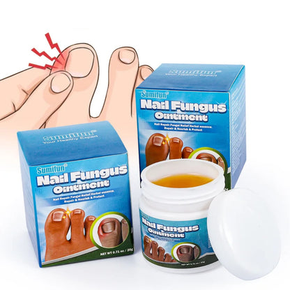 Nail Fungus Ointment pakovanje i otvorena krema