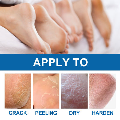 Prikaz primene stika za pete na razlicite probleme: pukotine, ljustenje, suva i gruba koza.