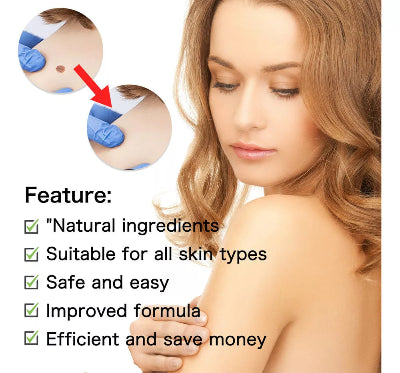 Prirodni sastojci za sigurno i efikasno uklanjanje bradavica, mladeza i koznih izraslina. Poboljsana formula pogodna za sve tipove koze.