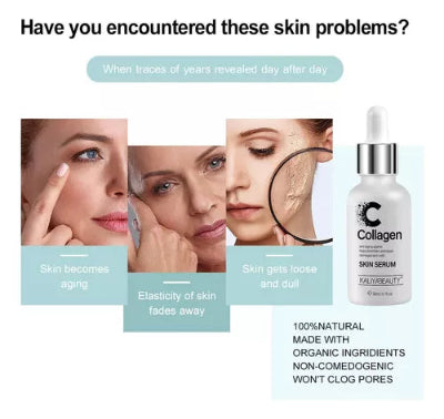 Prikaz problema sa kozom lica pre upotrebe seruma, fine linije, bore, neravnomerna tekstura.