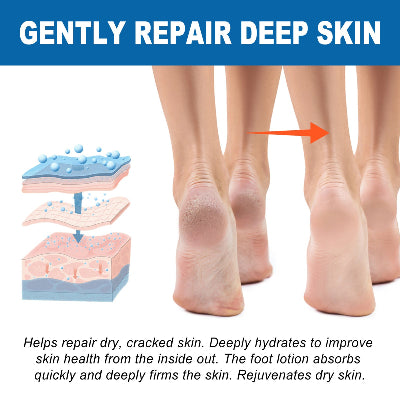  Ilustracija dubinske regeneracije i popravke grube i suve koze na petama, regenerativni efekat stika.