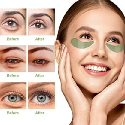 Rezultati koriscenja maske za podocnjake pre i posle. Smanjenje bora, tamnih kolutova i poboljsanje izgleda koze.