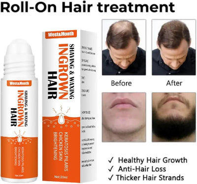  Roll-on tretman za kosu i bradu. Prikazuje rezultate pre i posle koriscenja, povecanje gustine dlake i rasta kose.