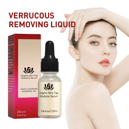 Serum za uklanjanje kožnih izraslina sa kapaljkom 20ml