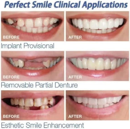 Primena Snap On Smile: rezultati pre i posle za razlicite probleme sa zubima. Savrsen osmeh je moguc brzo i jednostavno.