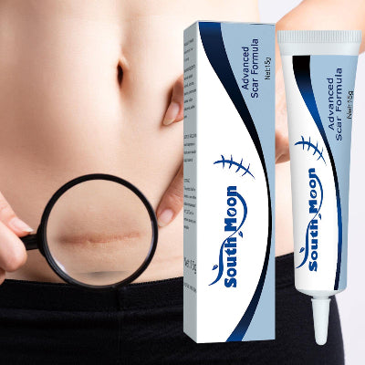 Krema za uklanjanje oziljaka i hiperpigmentacije. Prikaz kreme i krupni plan oziljka na stomaku, pokazuje efikasnost proizvoda.