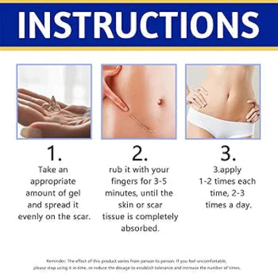 Uputstvo za upotrebu kreme za oziljke South Moon. Detaljne instrukcije za koriscenje gela za tretman oziljaka i strija.