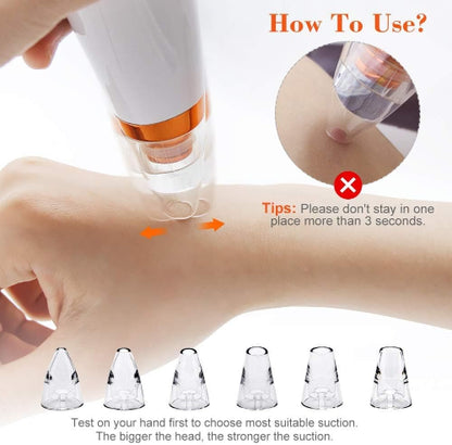 Uputstvo za koriscenje vakuumskog cistaca mitesera. Testiranje usisne moci i saveti za pravilno koriscenje na kozi lica.