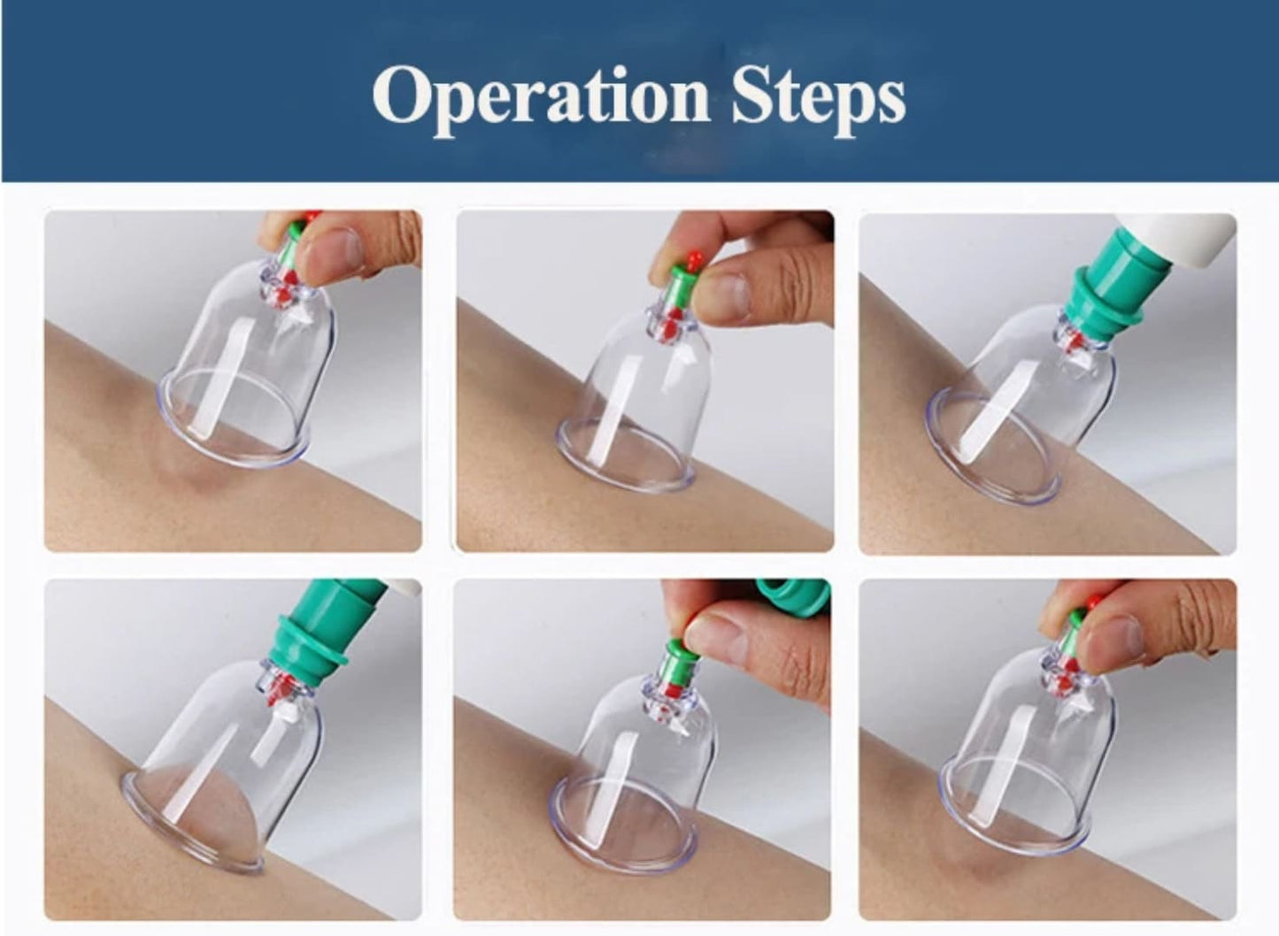 Uputstvo za koriscenje vakuum ventuza prikazuje korak po korak proces postavljanja na kozu radi poboljsanja cirkulacije