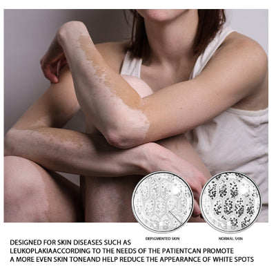 White Tag sprej za tretiranje leukoplakije. Deluje na bele mrlje na koži i depigmentaciju. Biljni ekstrakti pomažu u ujednačavanju tena.