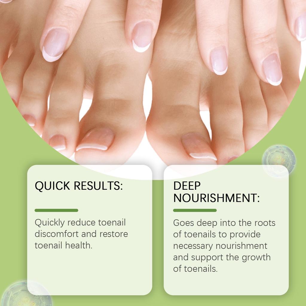 zdravi i negovani nokti posle tretmana protiv gljivica na stopalima