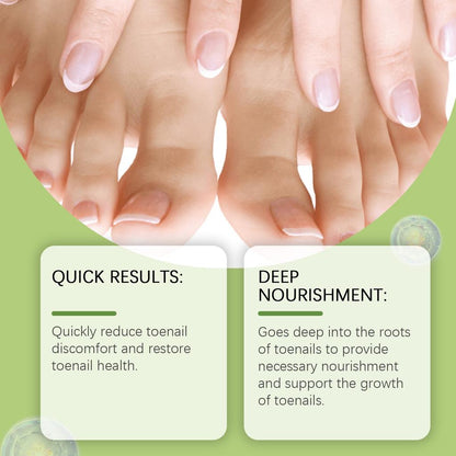 zdravi i negovani nokti posle tretmana protiv gljivica na stopalima